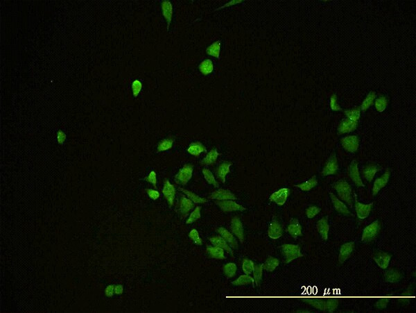 CD58 Antibody in Immunocytochemistry (ICC/IF)