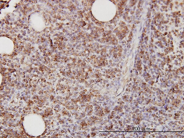 CD58 Antibody in Immunohistochemistry (Paraffin) (IHC (P))