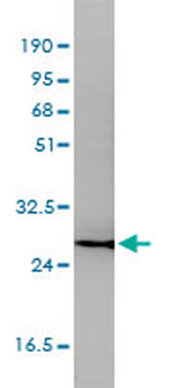 CD58 Antibody in Western Blot (WB)