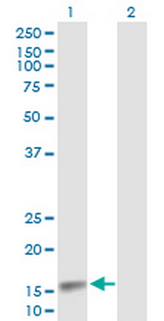 CDA Antibody in Western Blot (WB)