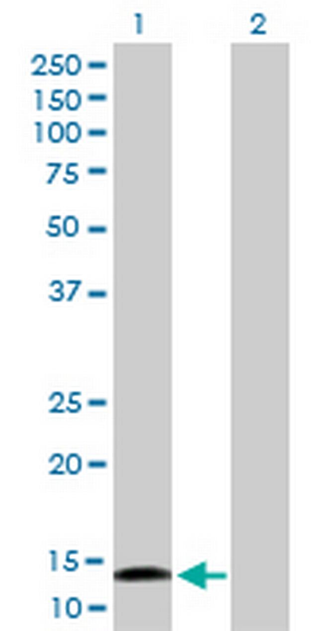 CDA Antibody in Western Blot (WB)