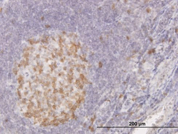 CDC2 Antibody in Immunohistochemistry (Paraffin) (IHC (P))