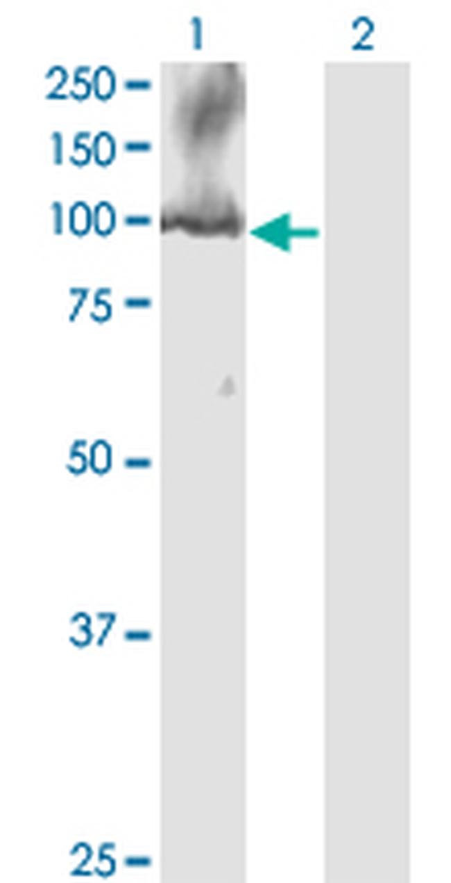 CDC5L Antibody in Western Blot (WB)