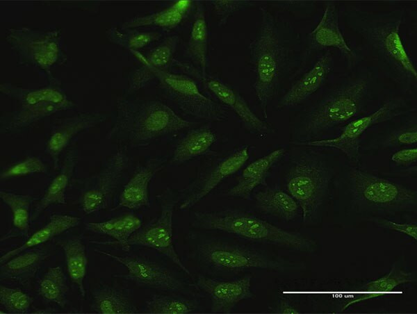 CDC6 Antibody in Immunocytochemistry (ICC/IF)