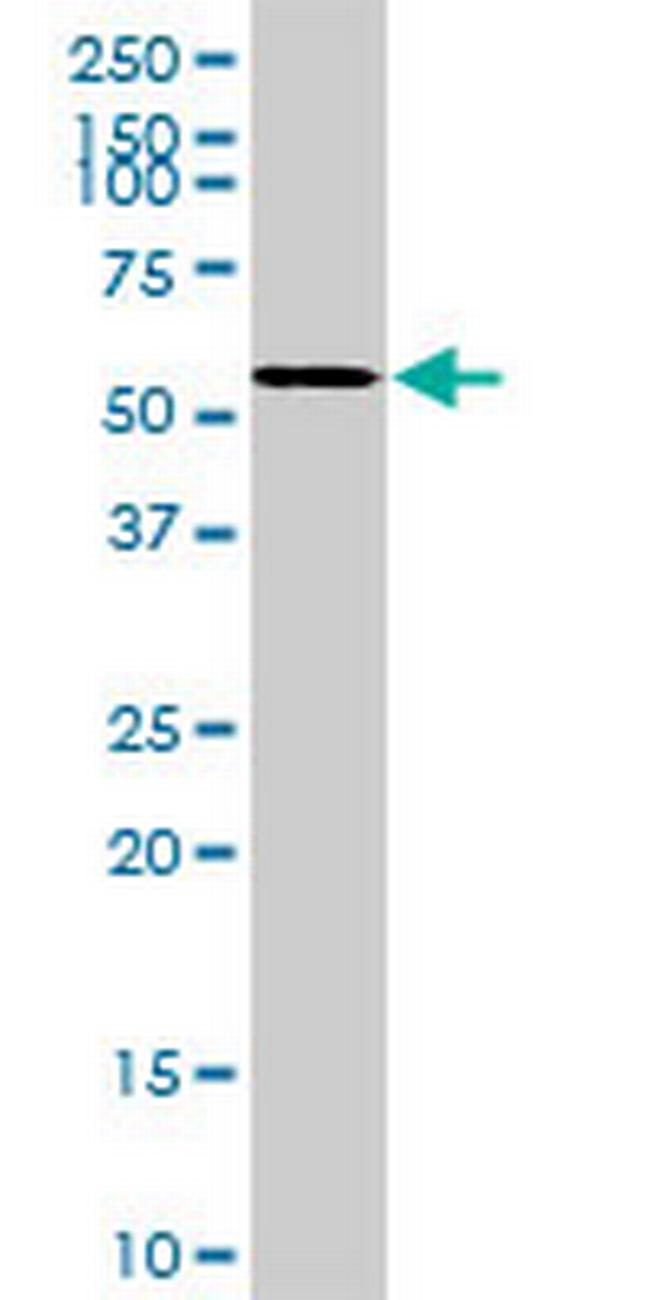 CDC25A Antibody in Western Blot (WB)