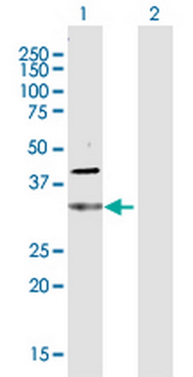 CDC34 Antibody in Western Blot (WB)