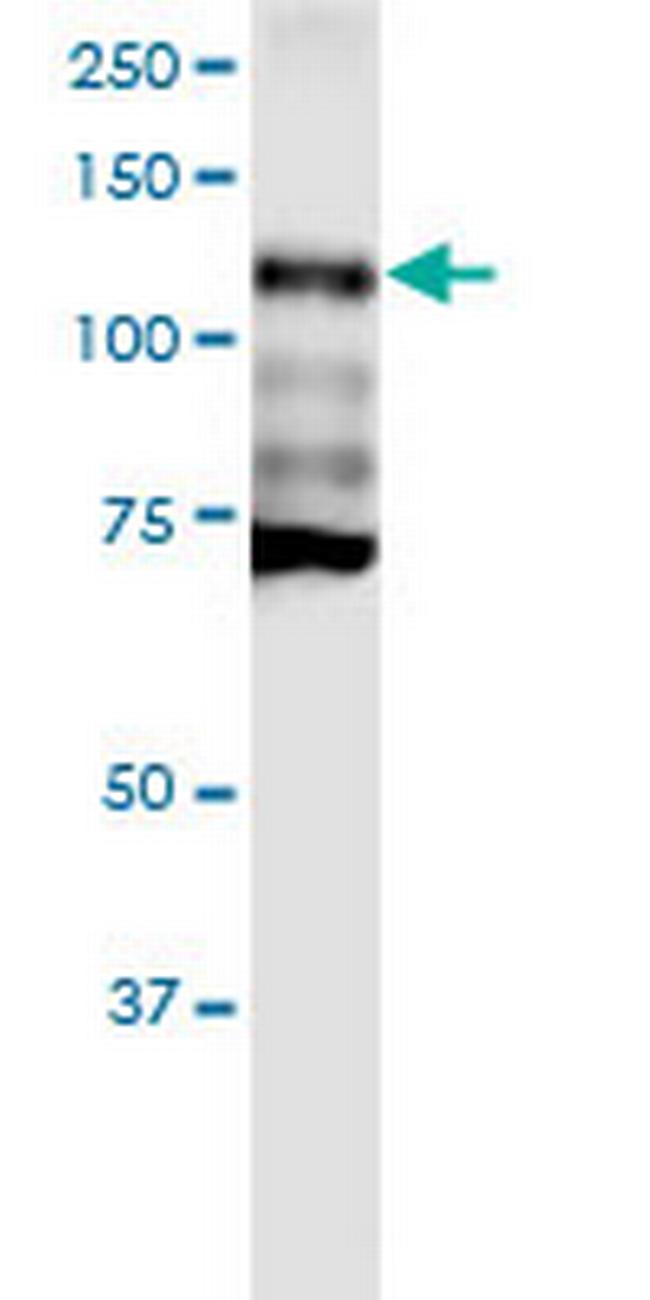 CDH1 Antibody in Western Blot (WB)