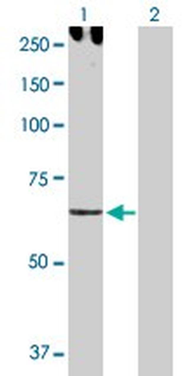 CDH6 Antibody in Western Blot (WB)