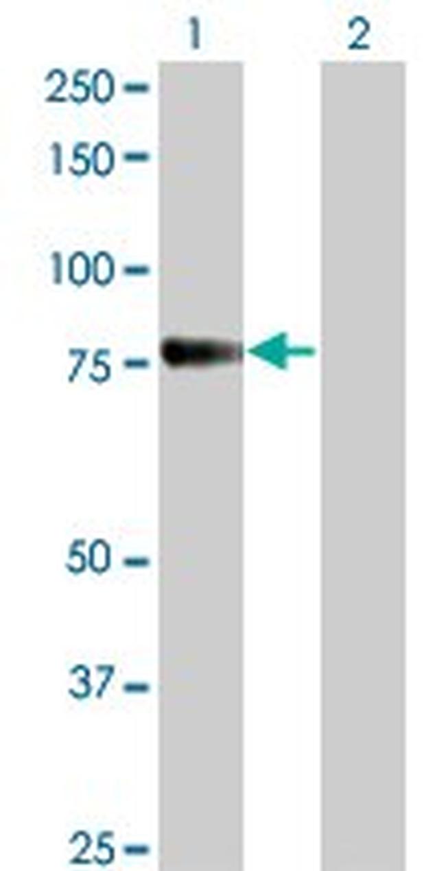 CDH6 Antibody in Western Blot (WB)