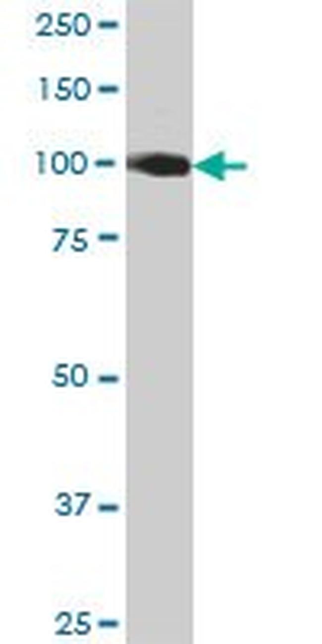 CDH13 Antibody in Western Blot (WB)