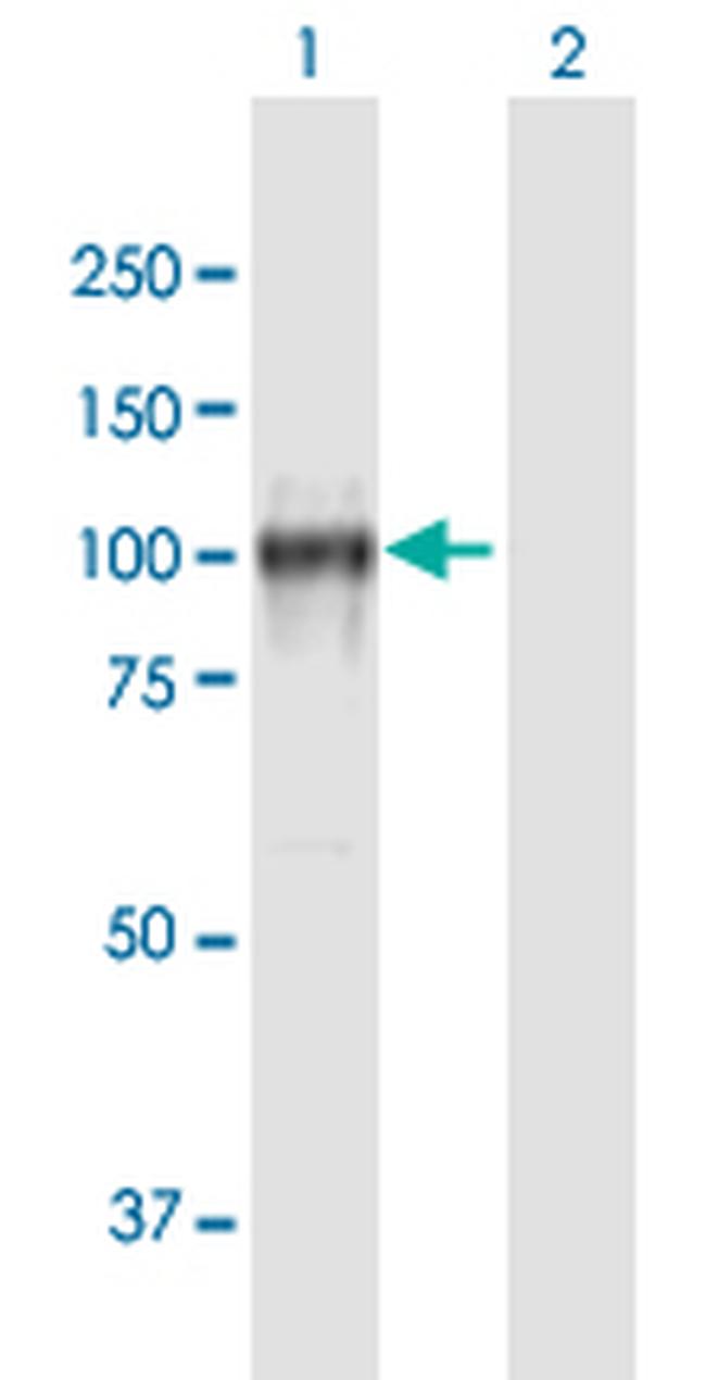 CDH13 Antibody in Western Blot (WB)