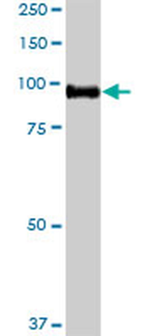 CDH13 Antibody in Western Blot (WB)