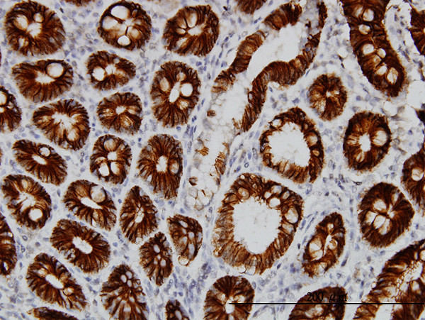 CDH17 Antibody in Immunohistochemistry (Paraffin) (IHC (P))