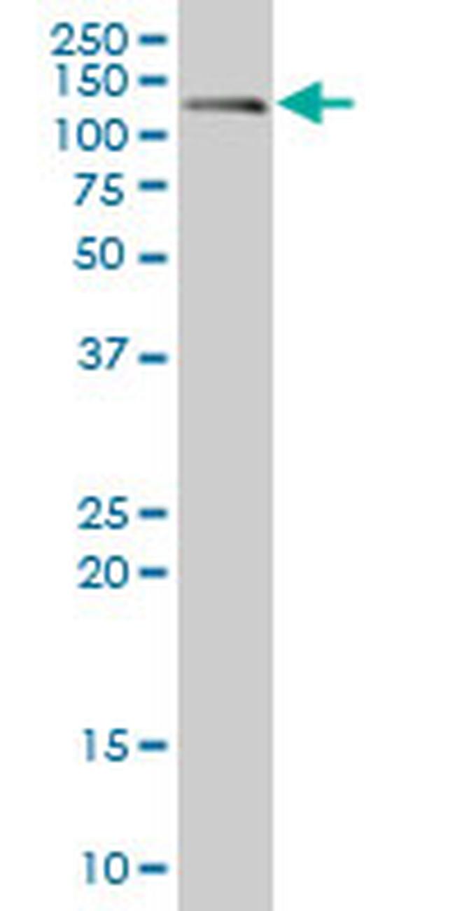 CDH17 Antibody in Western Blot (WB)