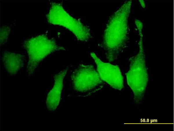 CDK5 Antibody in Immunocytochemistry (ICC/IF)