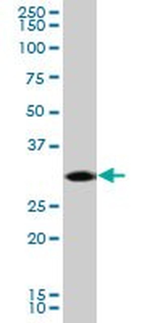 CDK5 Antibody in Western Blot (WB)