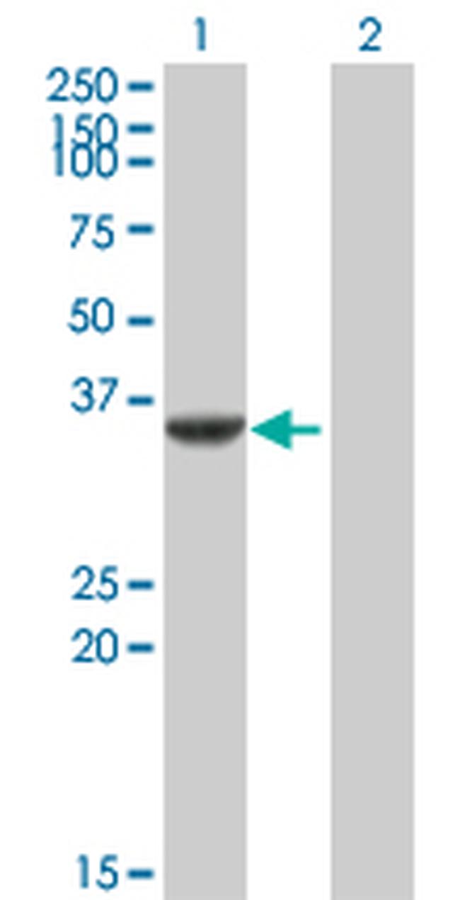 CDK5 Antibody in Western Blot (WB)