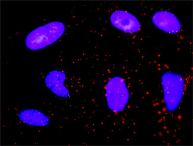 CDK6 Antibody in Proximity Ligation Assay (PLA) (PLA)