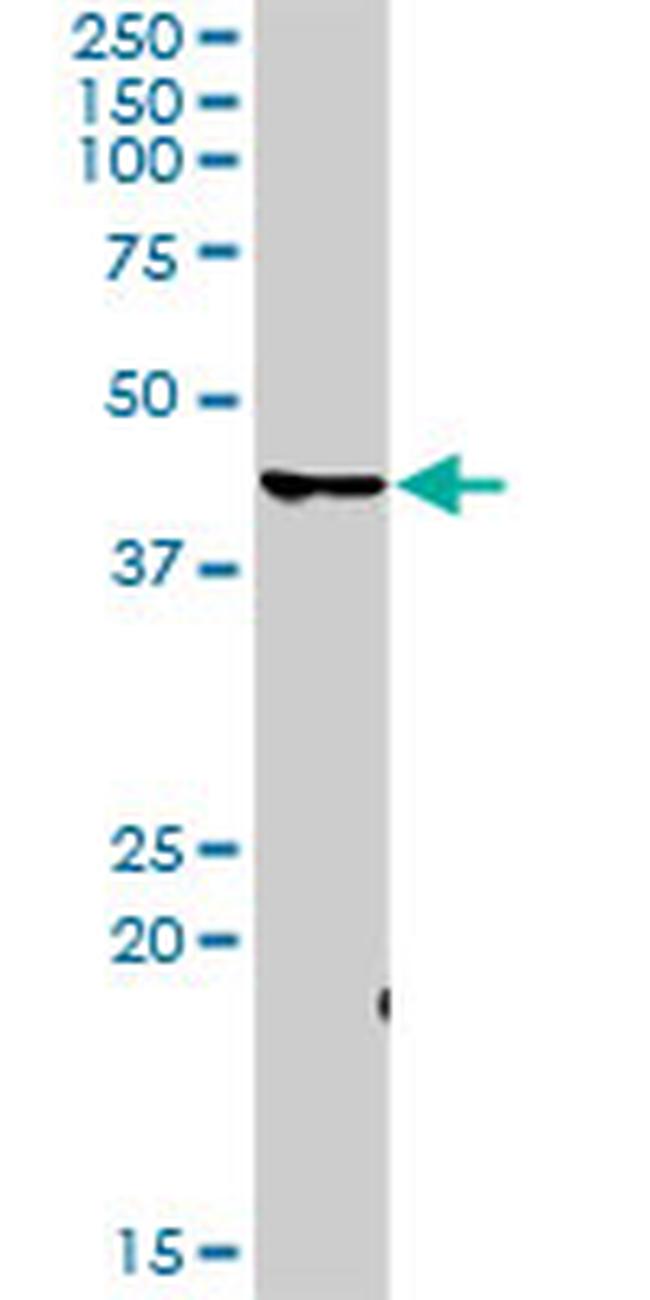 CDK7 Antibody in Western Blot (WB)