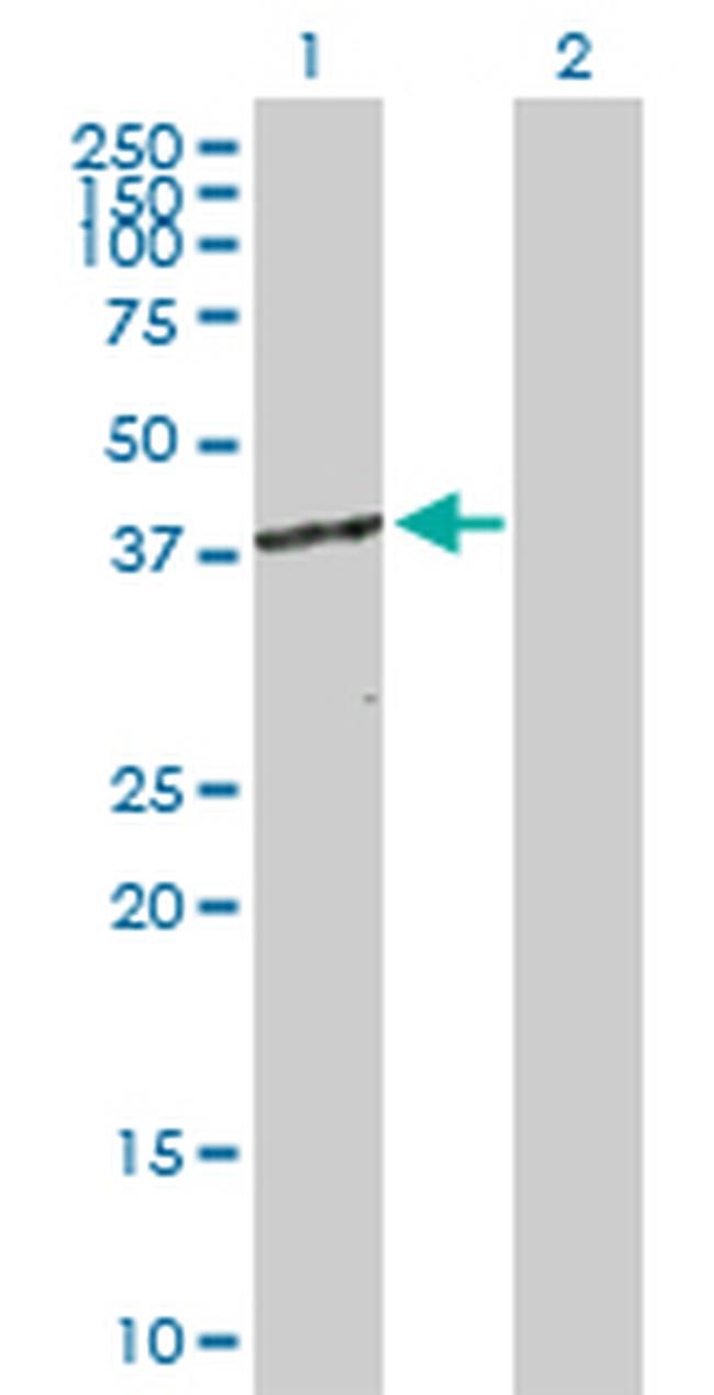 CDK7 Antibody in Western Blot (WB)