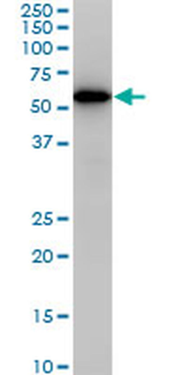 CDK8 Antibody in Western Blot (WB)