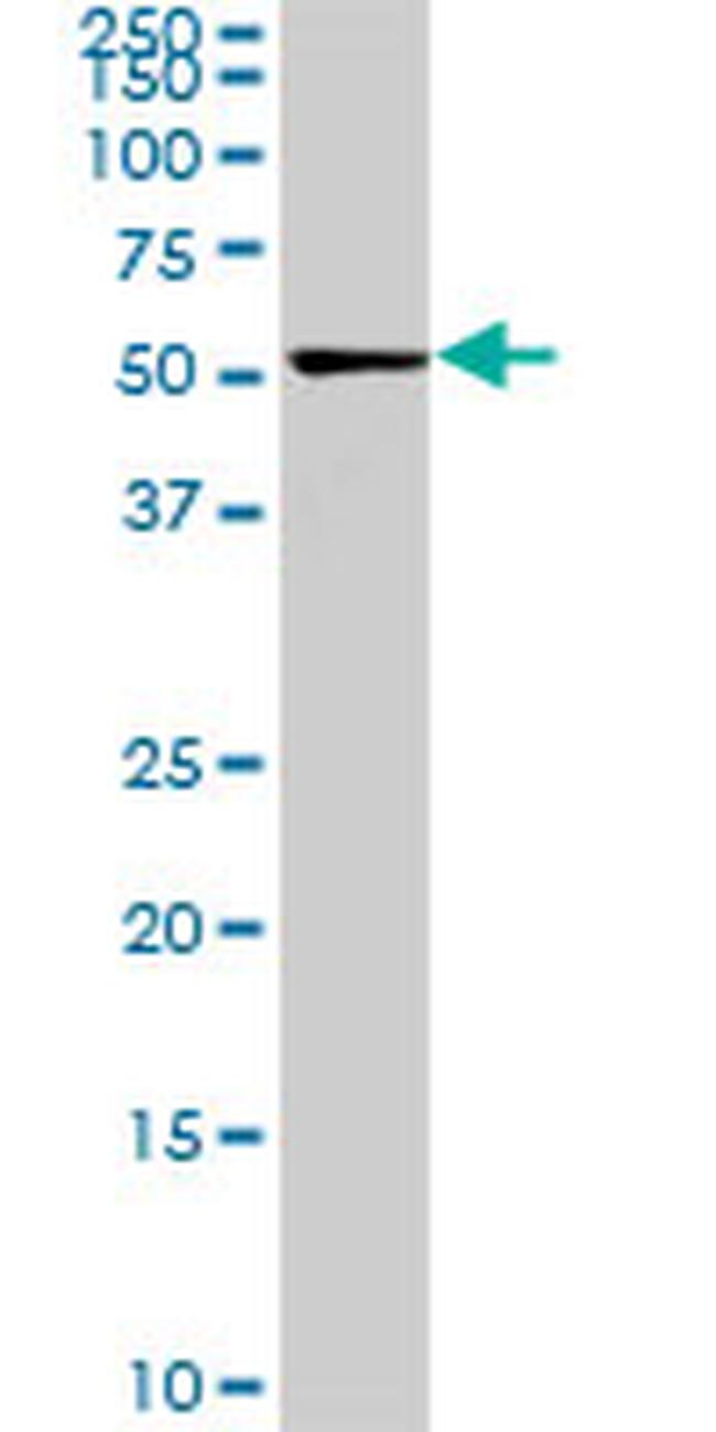 CDK8 Antibody in Western Blot (WB)