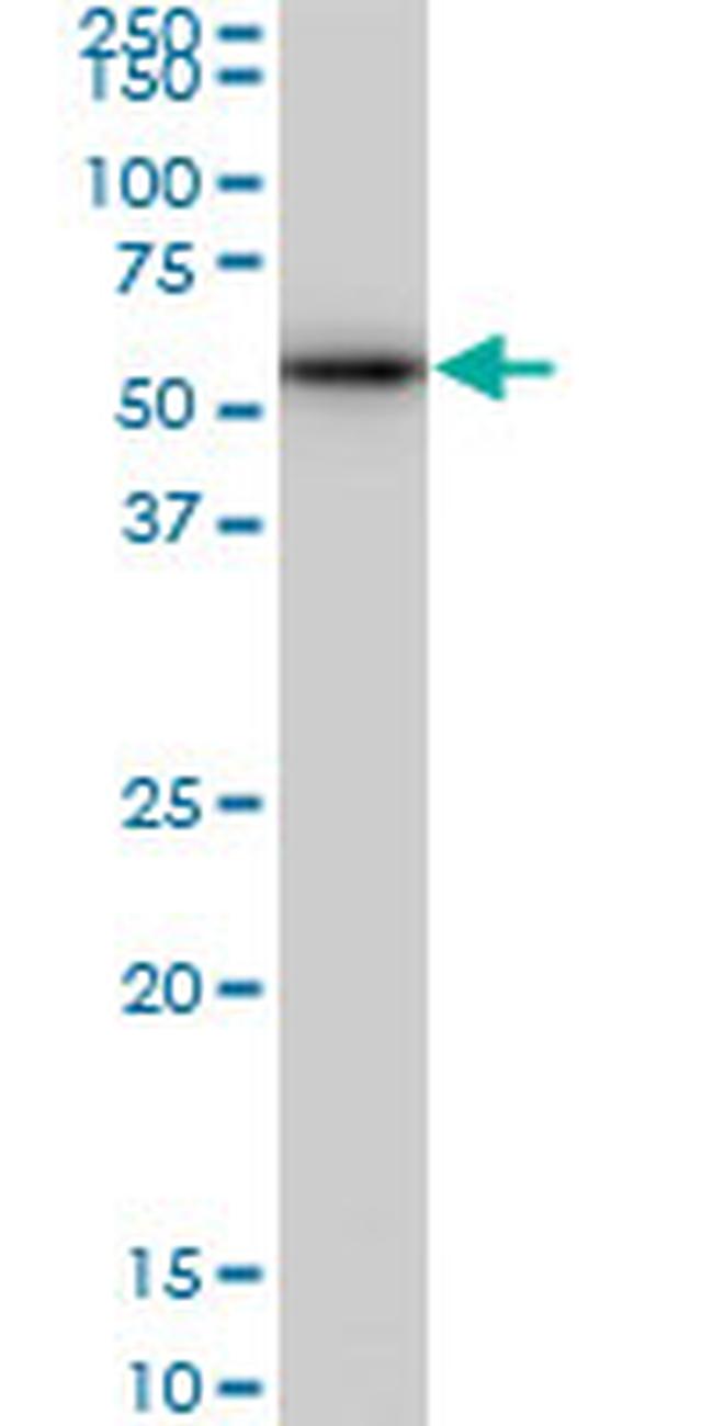 CDK8 Antibody in Western Blot (WB)