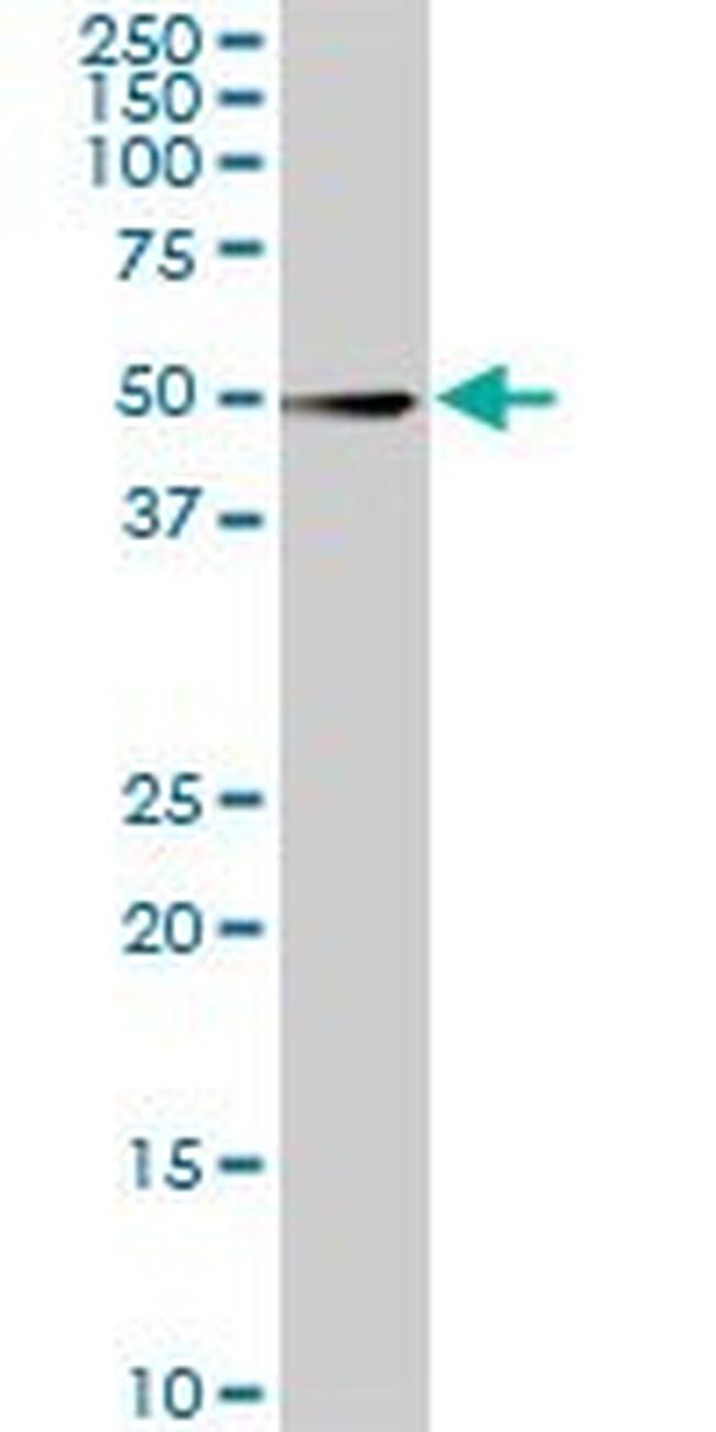 CDK8 Antibody in Western Blot (WB)