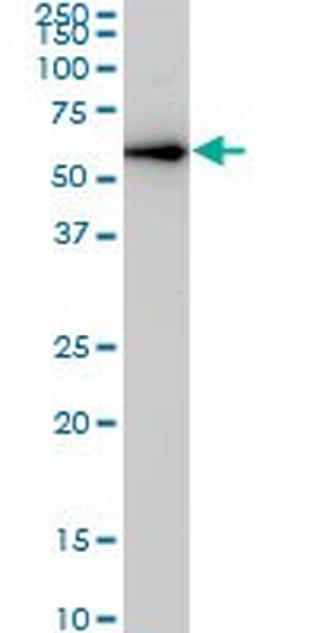 CDK8 Antibody in Western Blot (WB)