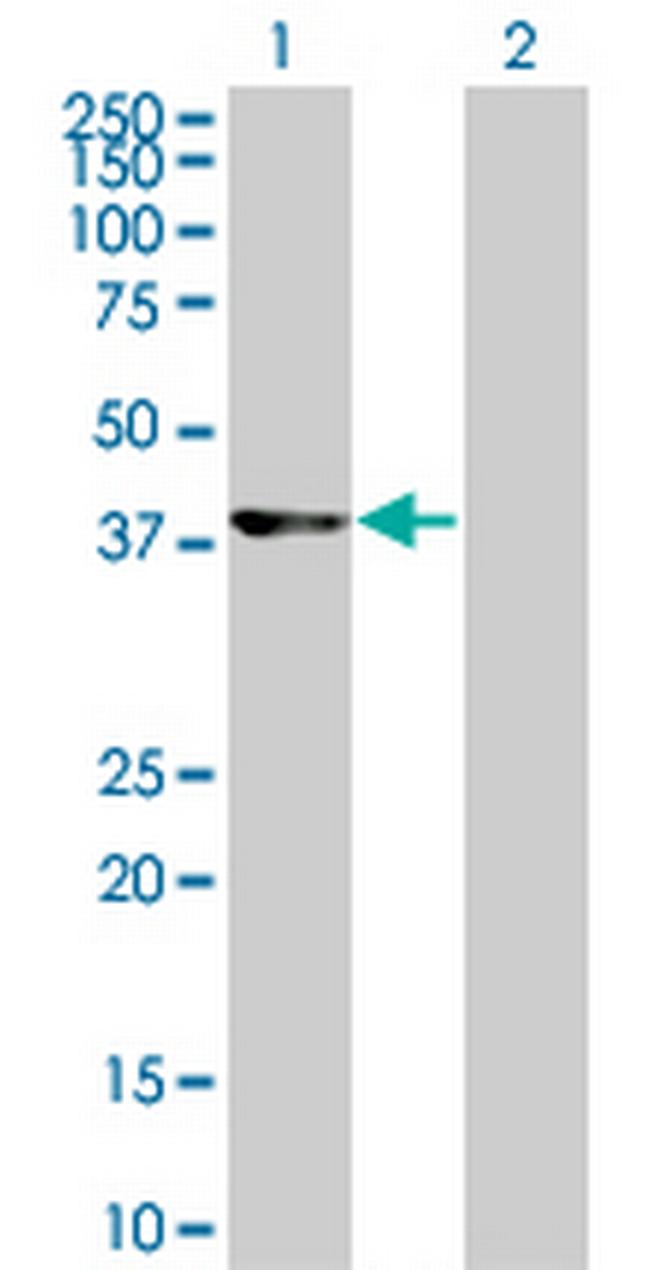 CDK9 Antibody in Western Blot (WB)