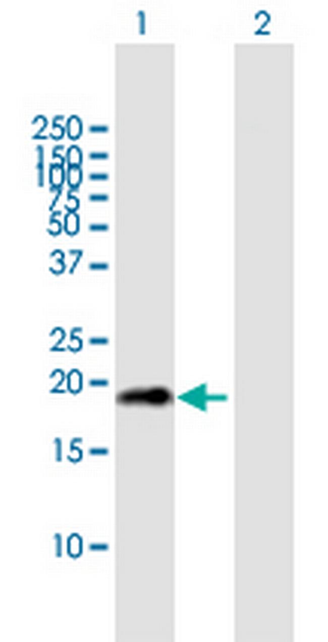 CDKN2D Antibody in Western Blot (WB)