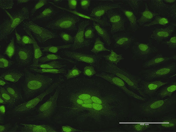 CDKN2D Antibody in Immunocytochemistry (ICC/IF)