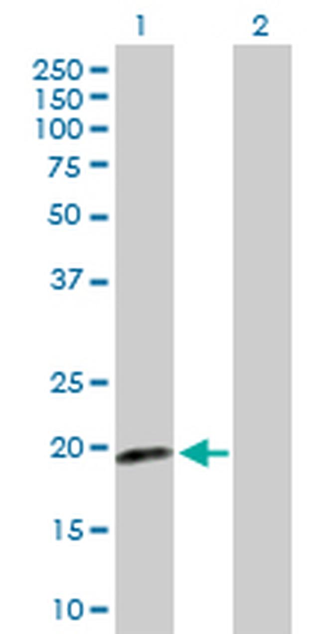 CDKN2D Antibody in Western Blot (WB)