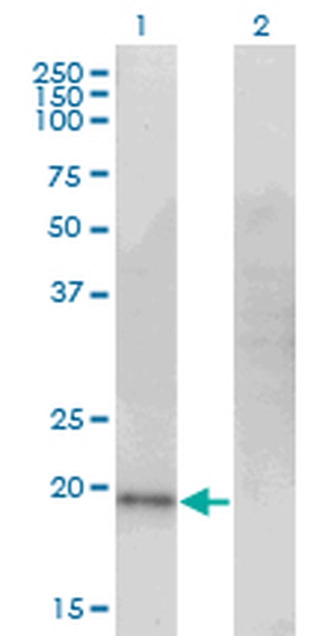 CDO1 Antibody in Western Blot (WB)