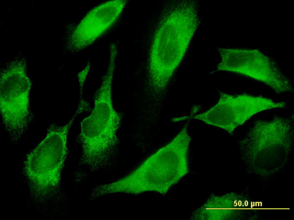 CDS1 Antibody in Immunocytochemistry (ICC/IF)