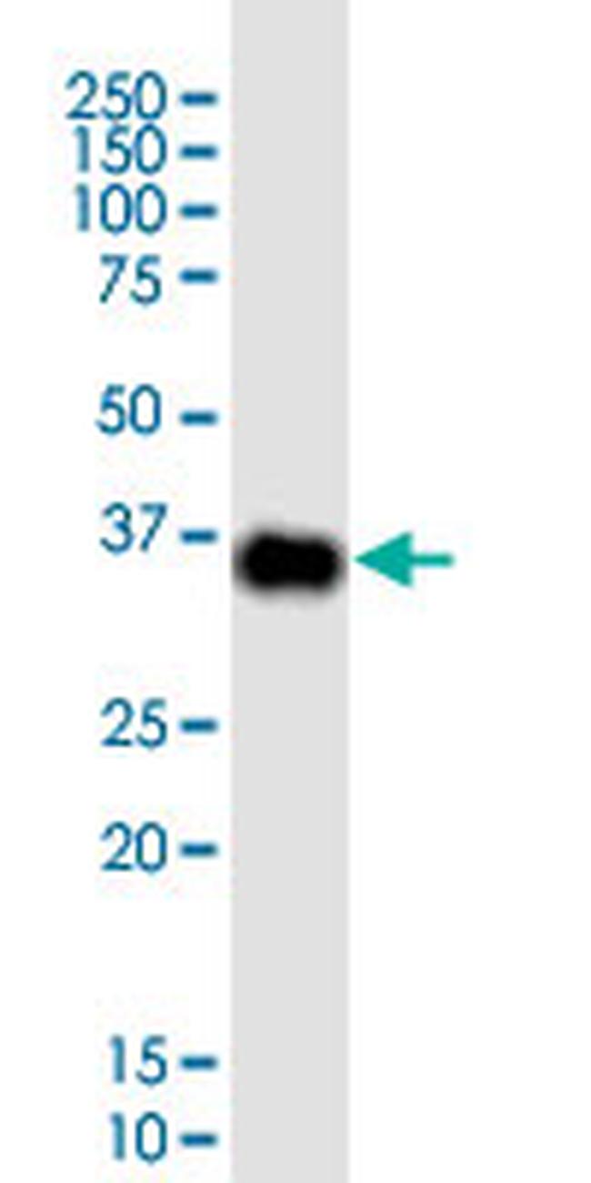 CDX2 Antibody in Western Blot (WB)