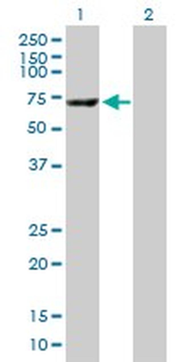 CES1 Antibody in Western Blot (WB)