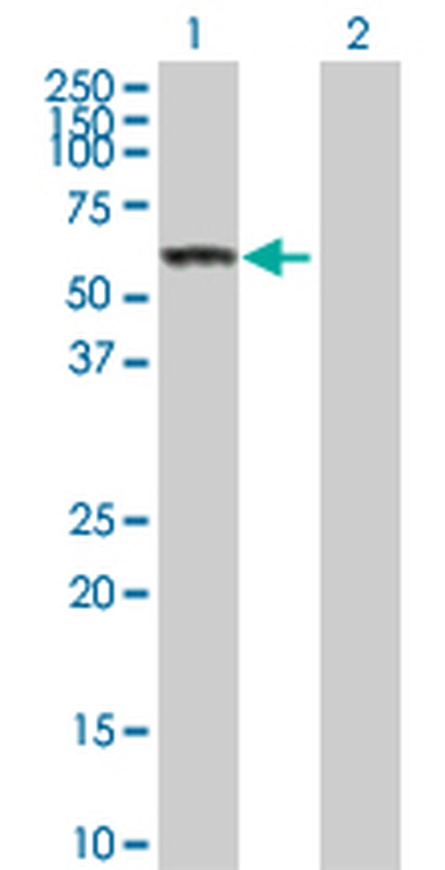 CES1 Antibody in Western Blot (WB)