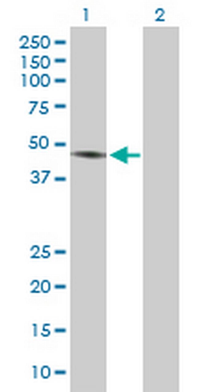 RCC1 Antibody in Western Blot (WB)