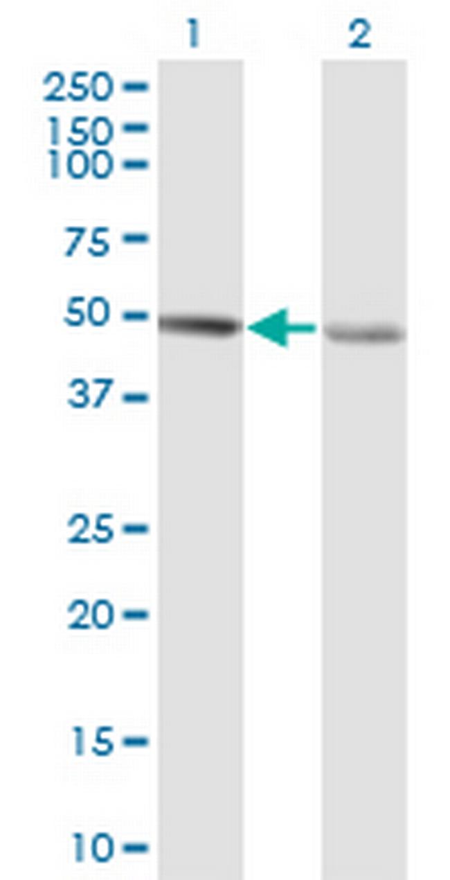 RCC1 Antibody in Western Blot (WB)