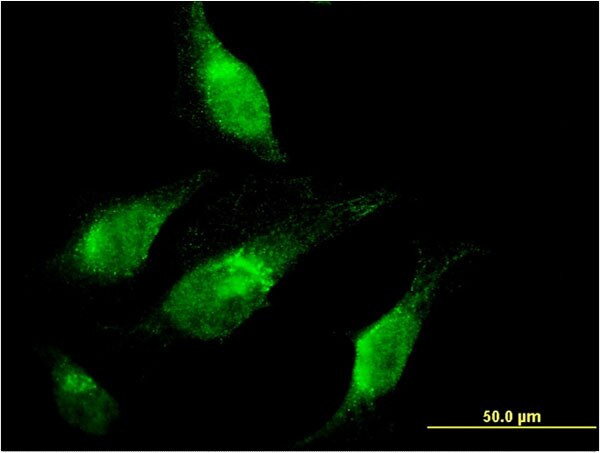 CHD1 Antibody in Immunocytochemistry (ICC/IF)