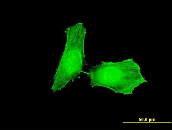 CHEK1 Antibody in Immunocytochemistry (ICC/IF)