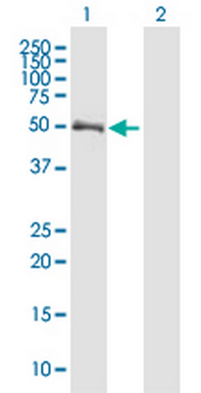 CHIT1 Antibody in Western Blot (WB)