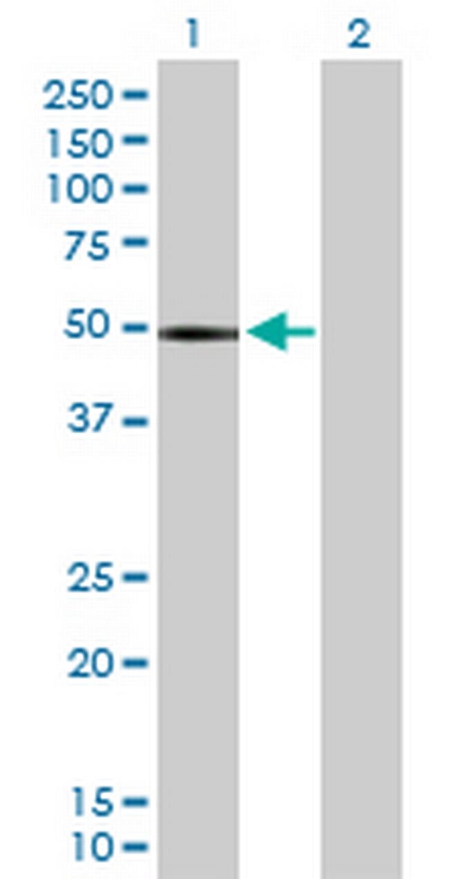 CHIT1 Antibody in Western Blot (WB)