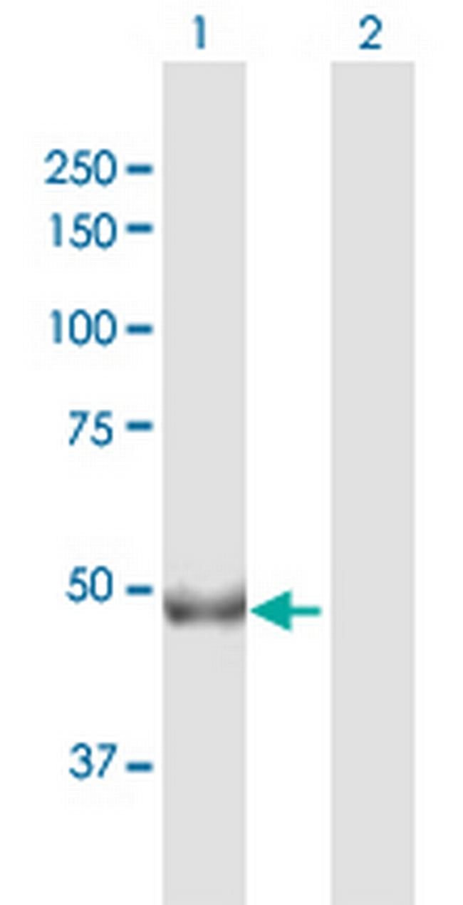 CHKA Antibody in Western Blot (WB)