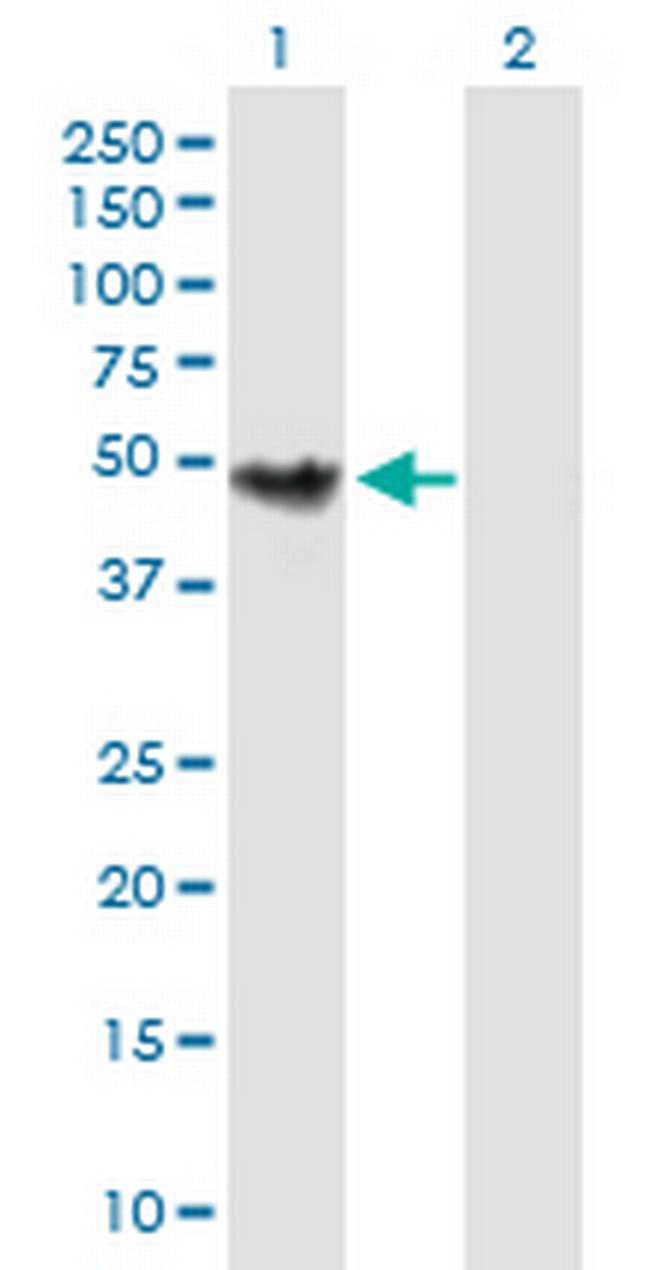 CHKB Antibody in Western Blot (WB)