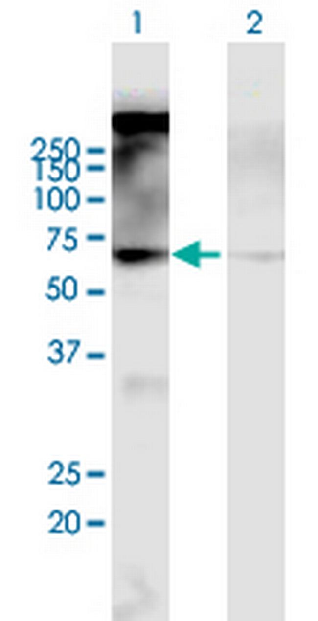 CHRM2 Antibody in Western Blot (WB)