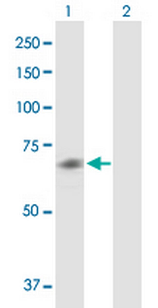 CHRM5 Antibody in Western Blot (WB)