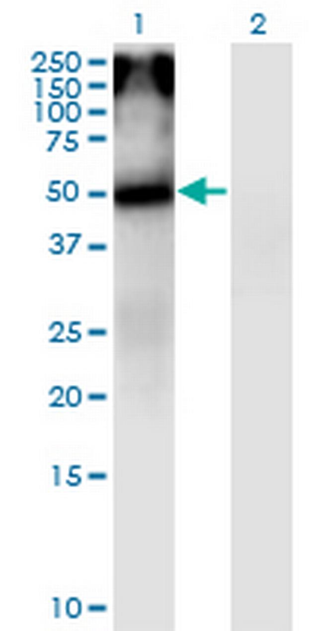 CHRNA5 Antibody in Western Blot (WB)