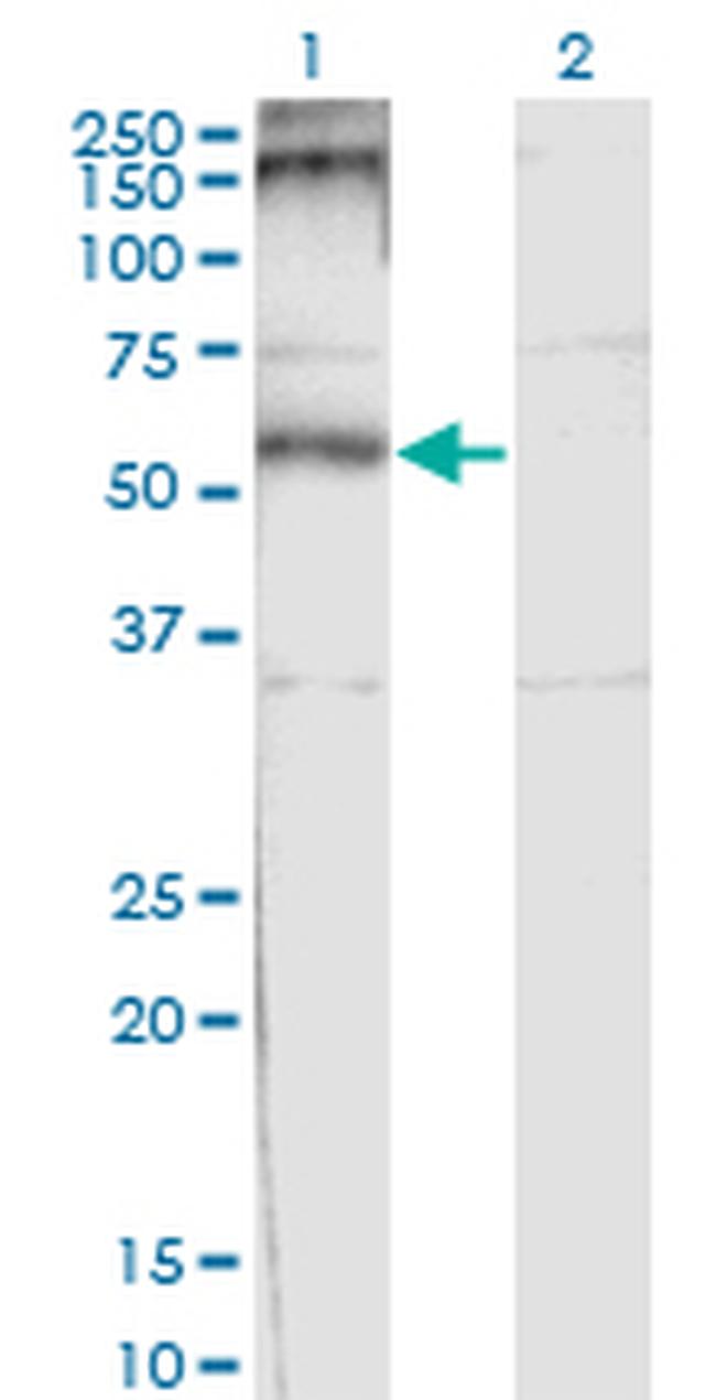 CHRND Antibody in Western Blot (WB)